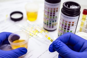 drug-testing